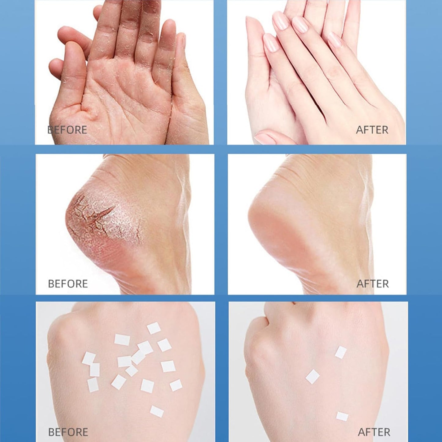 Set 1+1 Crema Ultra Hidratanta HIH, Pentru Piele Uscata si Crapata, Ingrediente Naturale, 35 g, Stick/RollOn